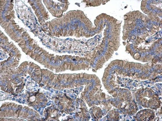 Anti-EEF1B2