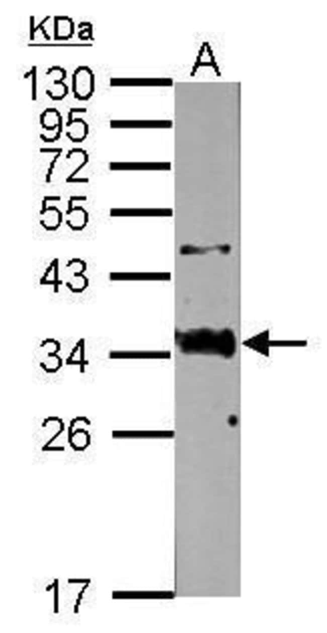 Anti-Surfactant Protein A
