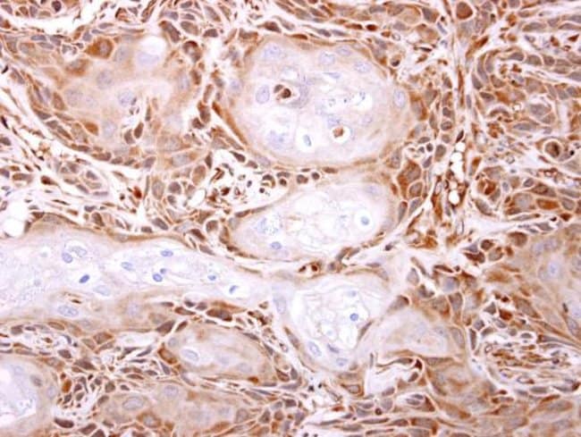 Anti-ITPase