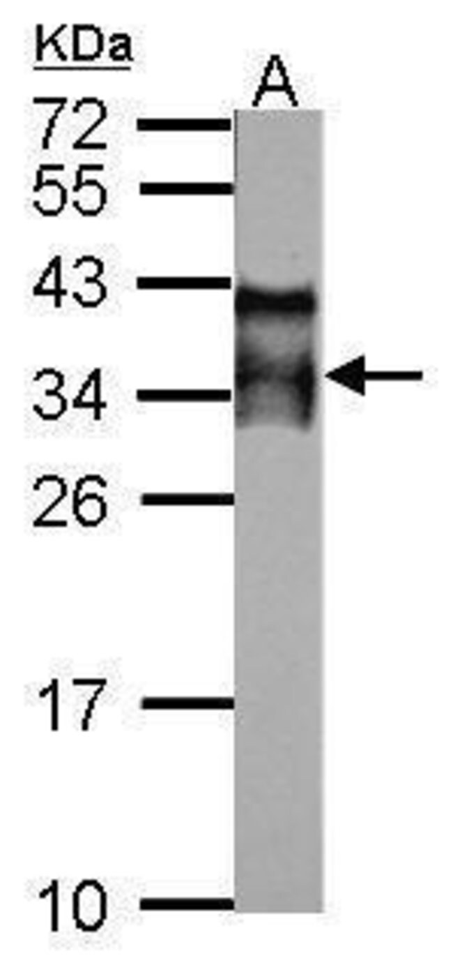 ANTI-ACROSOMAL VESICLE PROTEIN