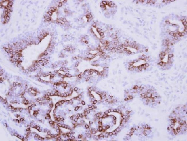 Anti-Nodal