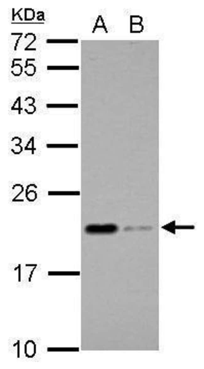 Anti-Apolipoprotein M
