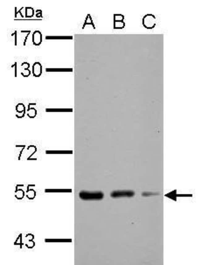Anti-KBTBD4