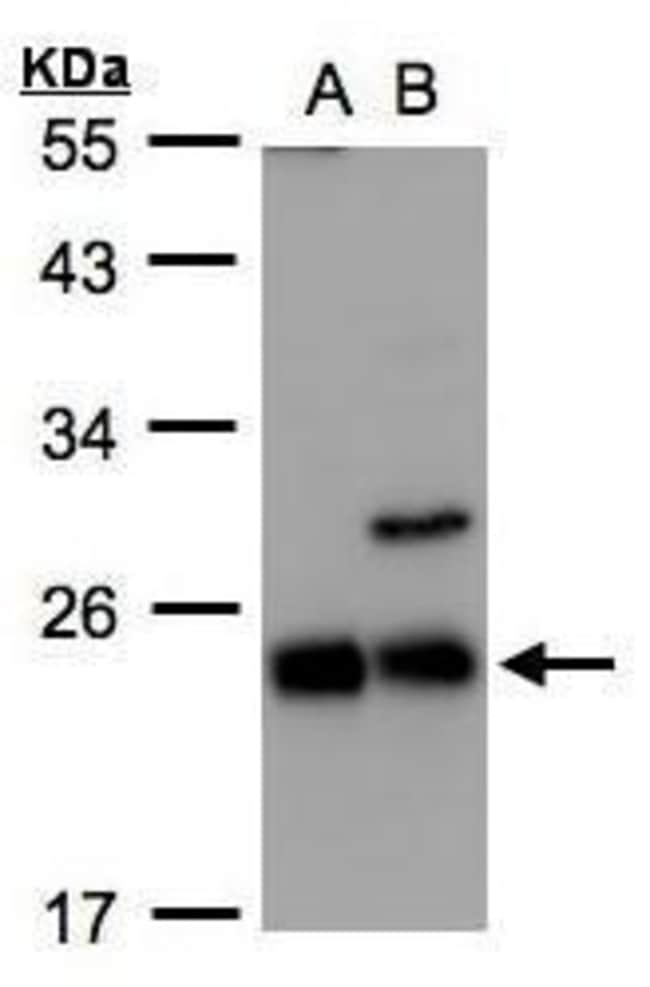 Anti-PEBP2beta