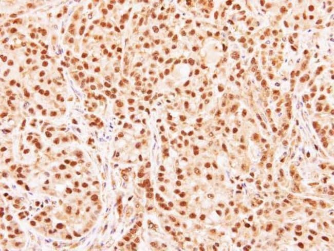 Anti-RG9MTD3