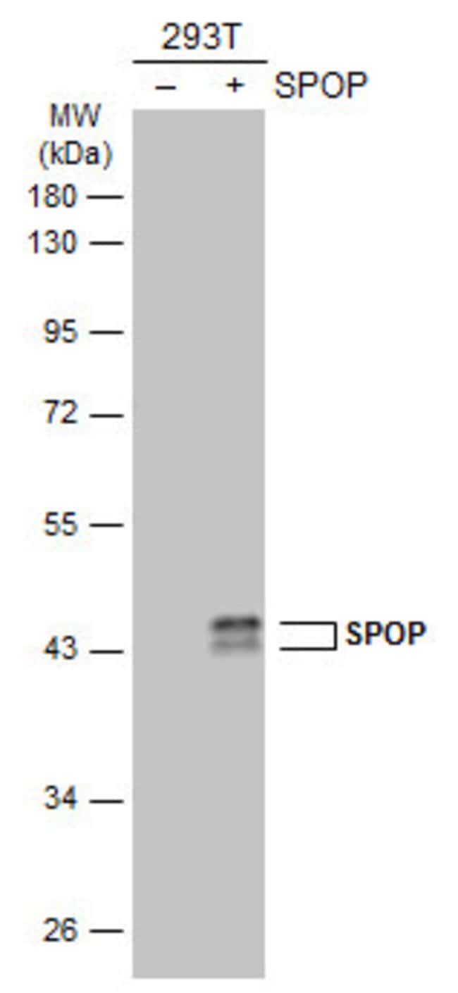 Anti-SPOP