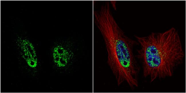 Anti-PRP19