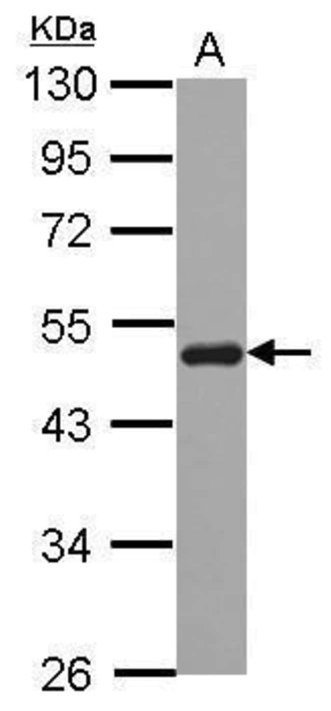 Anti-SNX5