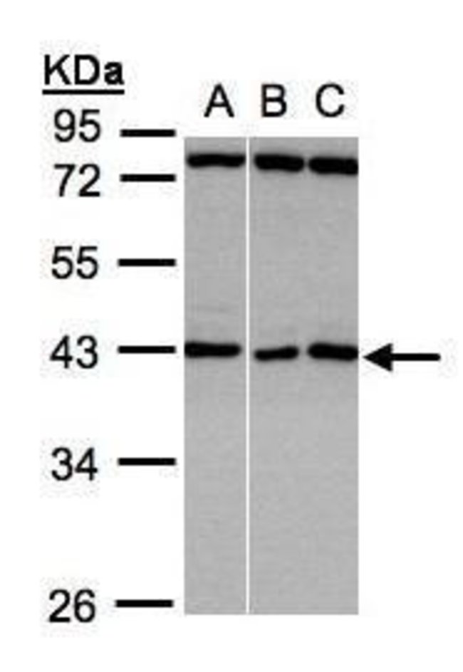 Anti-ASB5