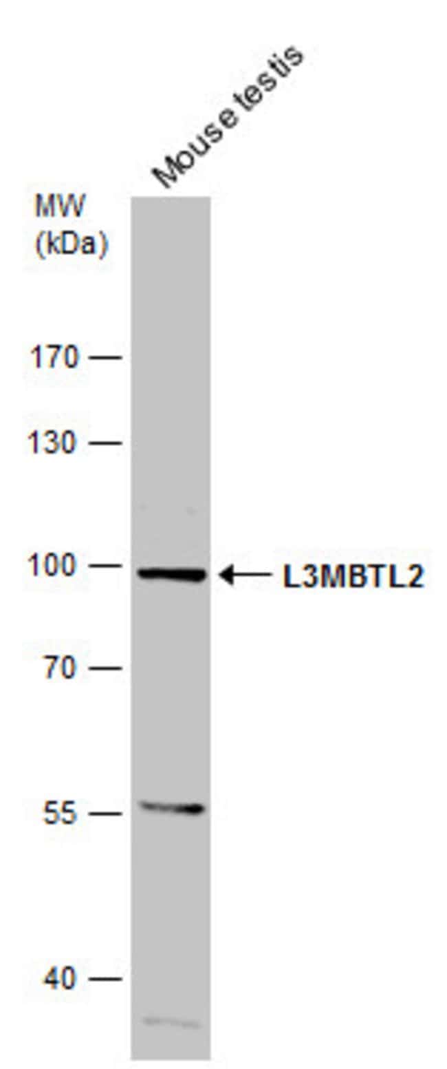 Anti-L3MBTL2