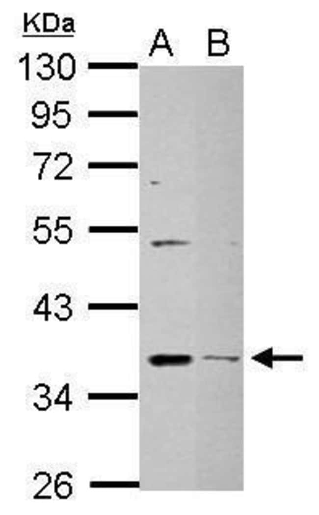 Anti-DHRS9