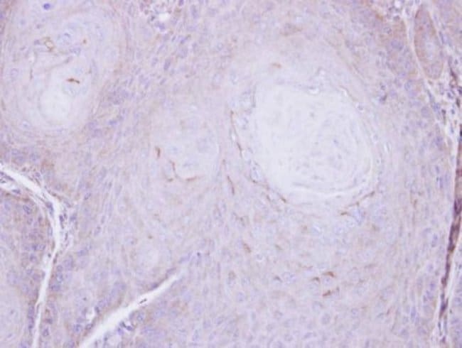 Anti-C16orf62