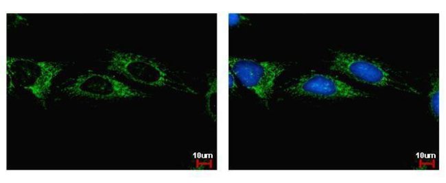 Anti-ALDH1B1