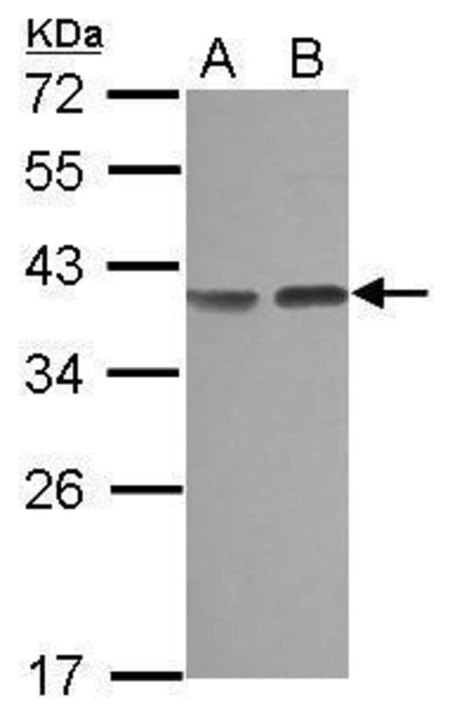 Anti-CA8