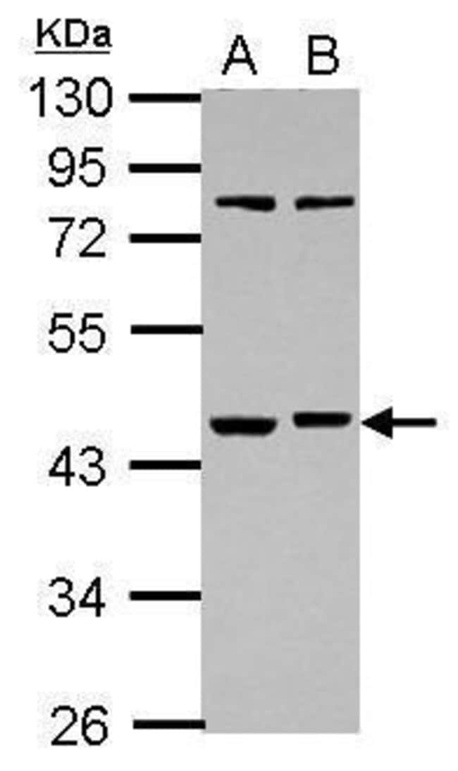 Anti-RBMS1