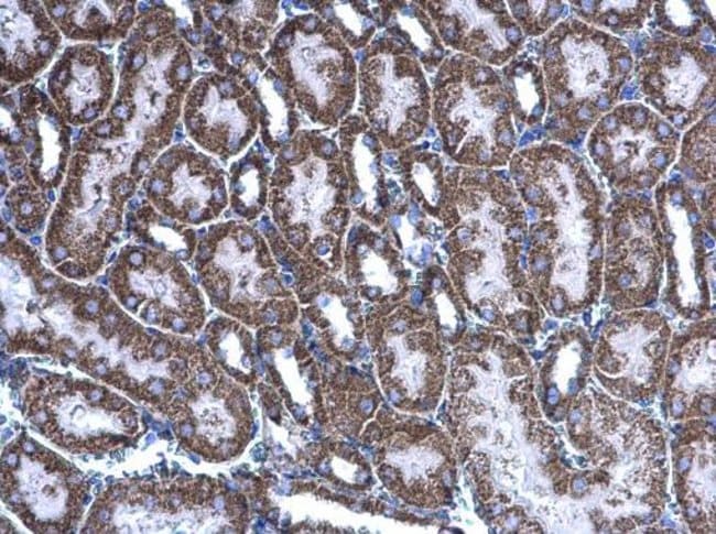 Anti-Acylglycerol kinase