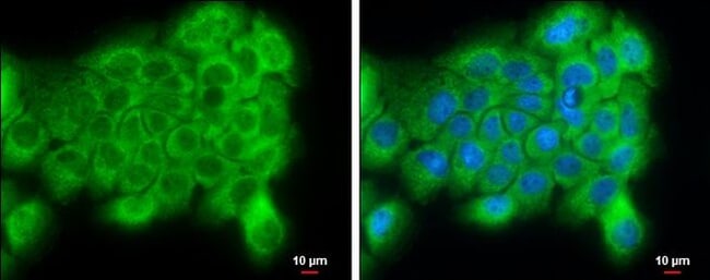 Anti-PI4 kinase alpha
