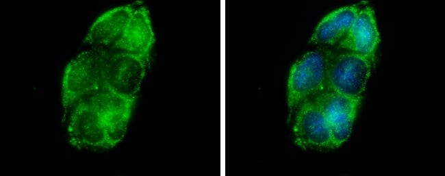 Anti-Glycerol kinase