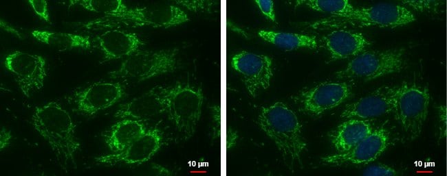 Anti-Adenylate kinase 3