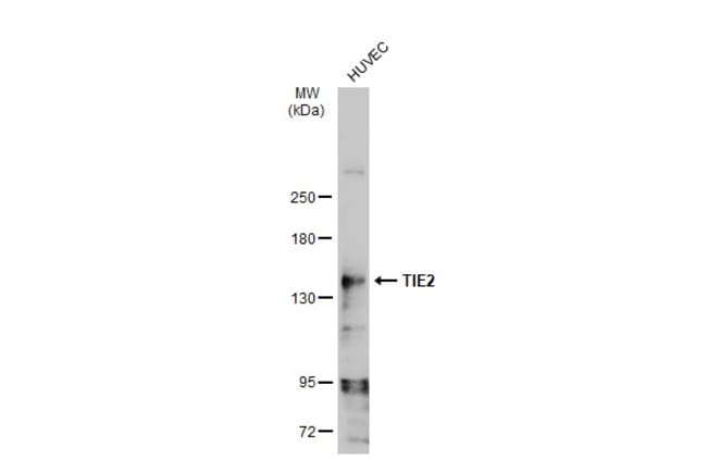 CD202b/TIE2 polyclonal human antibody