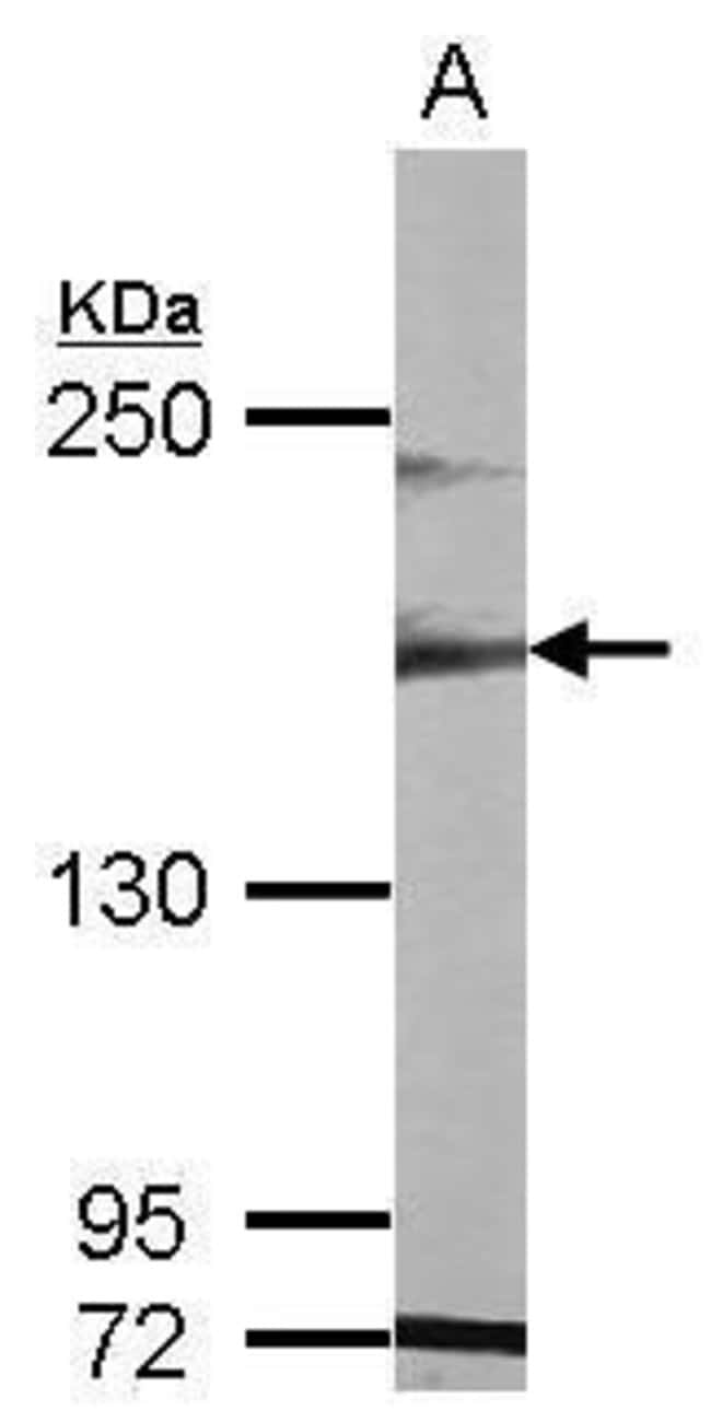 Anti-MAST1
