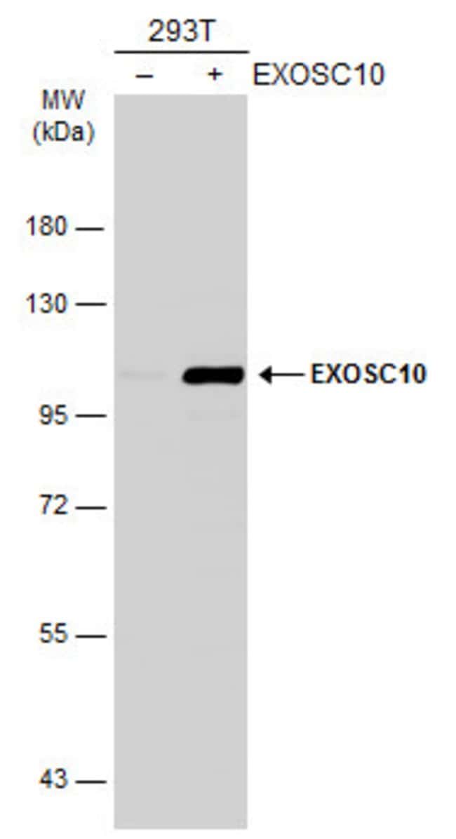 Anti-EXOSC10