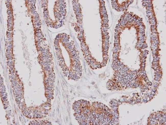 Anti-Glycerol kinase 2
