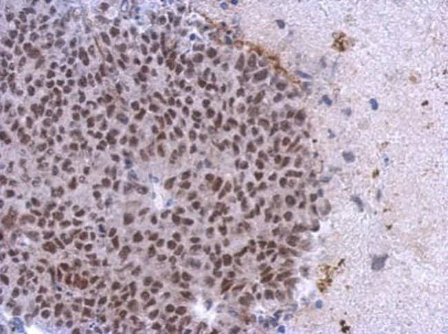 Anti-Casein Kinase 2 alpha