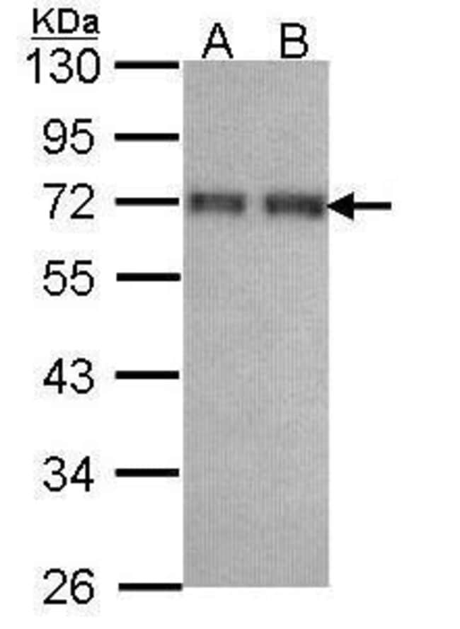 Anti-CCDC6