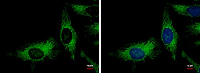 Anti-Adenylate kinase 2