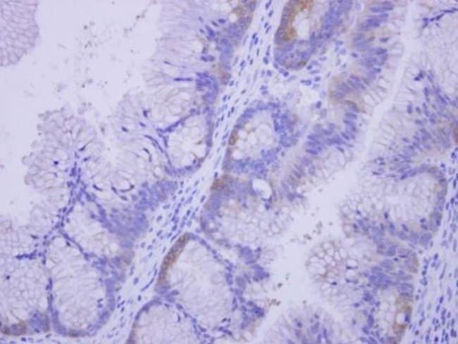 Anti-CoA synthase