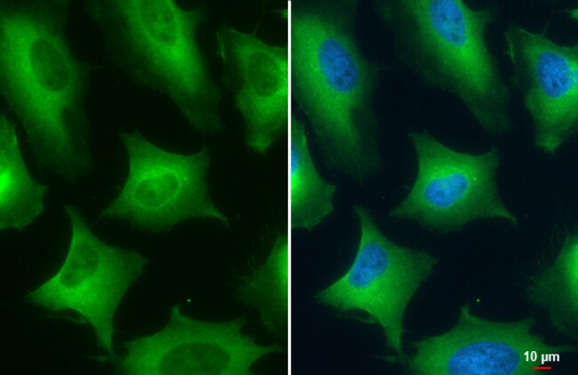 Anti-Pyruvate Kinase (muscle)