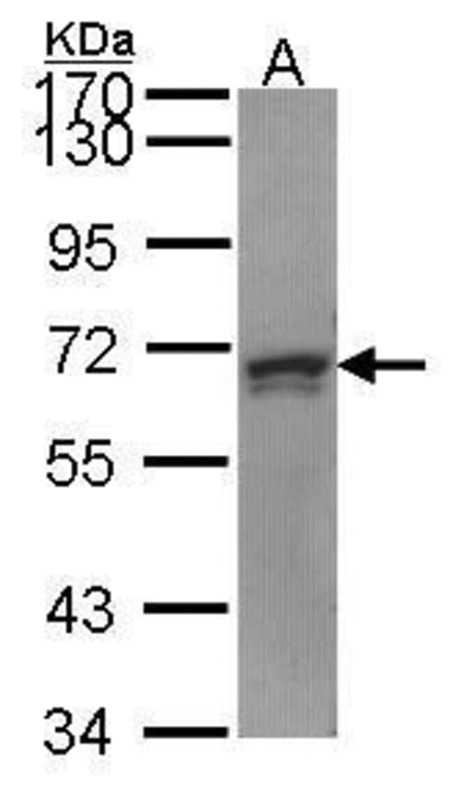 Anti-PRPF31