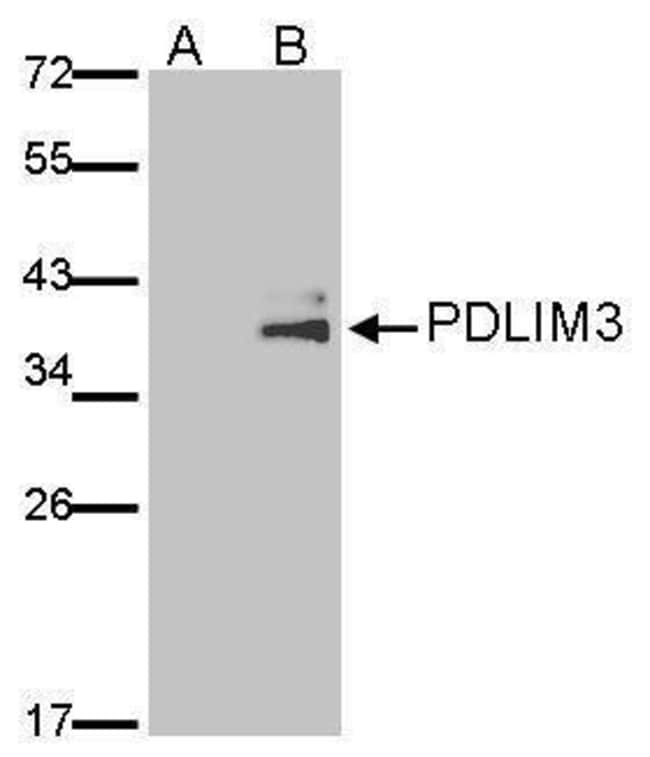 Anti-PDLIM3