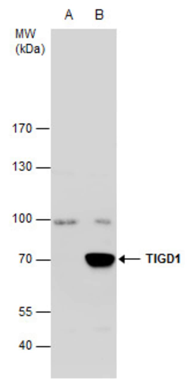 Anti-TIGD1