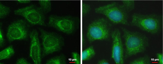 Anti-PFKFB4