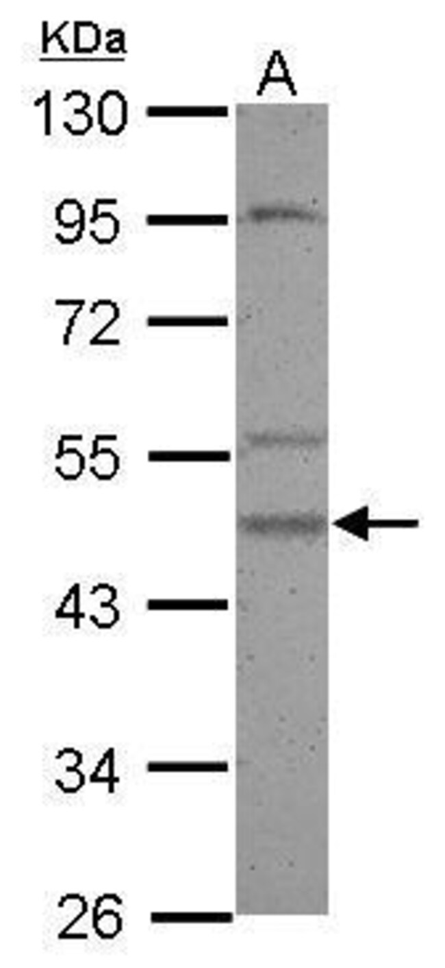 Anti-Casein Kinase 1 gamma 2