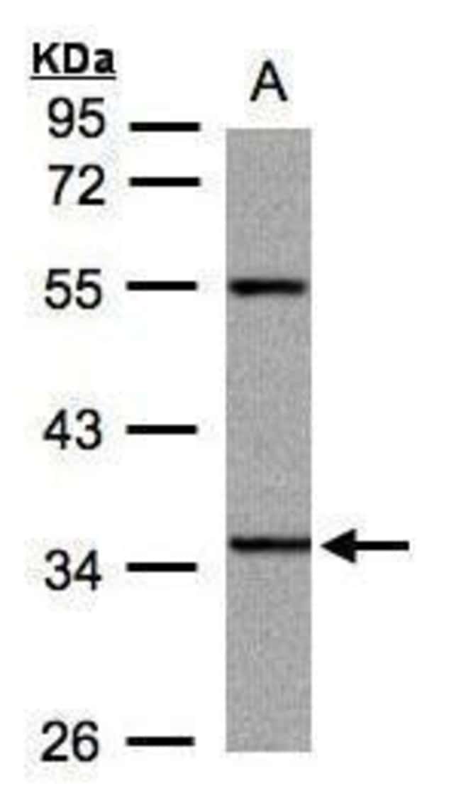 Anti-PANK3