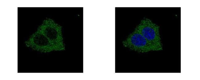Anti-GLYCTK