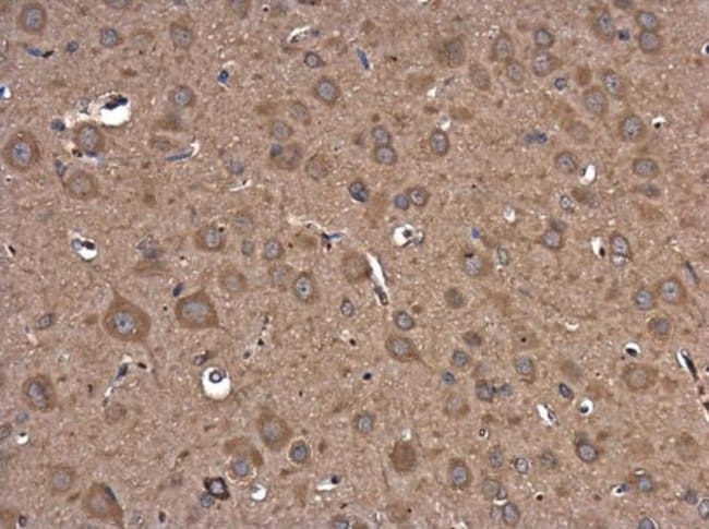 Anti-PI3 kinase p101