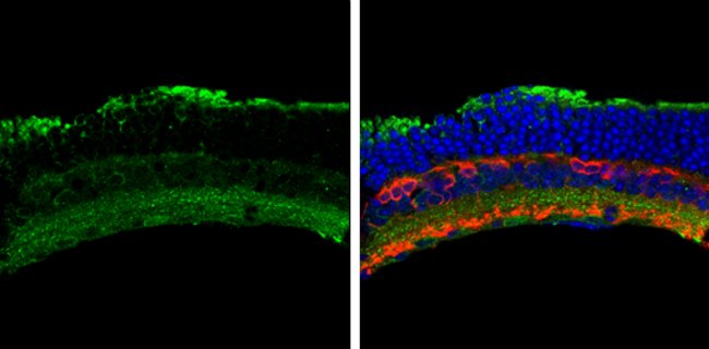 ANTI-ACTIVIN A RECEPTOR TYPE I