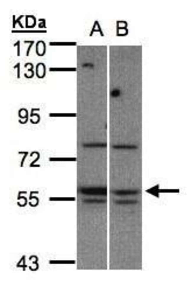 Anti-STK24