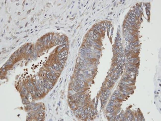ANTI-PHOSPHOGLYCERATE KINASE 2