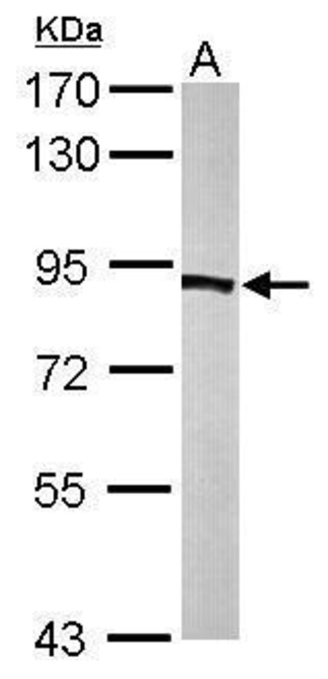 Anti-PFK (platelet)
