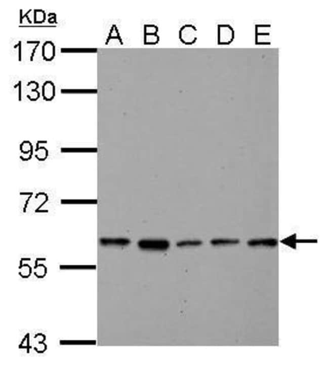 ANTI-PYRUVATE KINASE (LIVER/RBC)