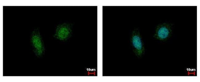 Anti-Casein Kinase 2 alpha 1