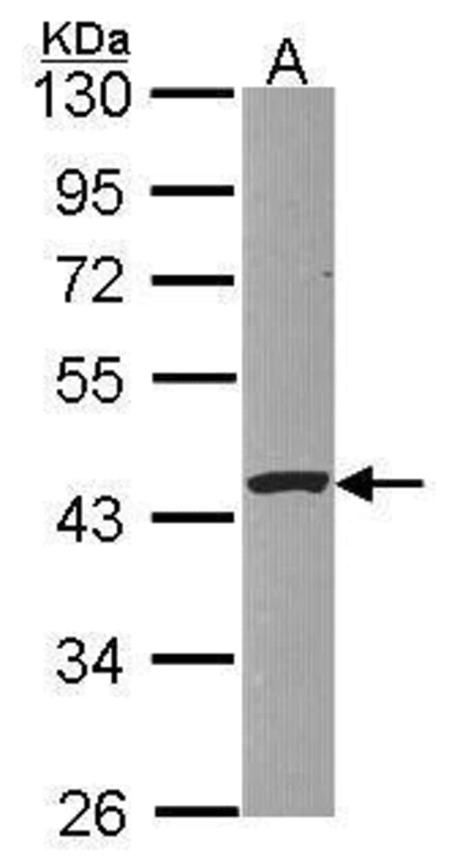 Anti-PSKH1
