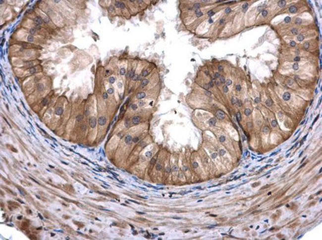 Anti-CoA synthase