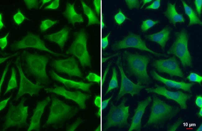 Anti-Pyruvate Kinase (muscle)