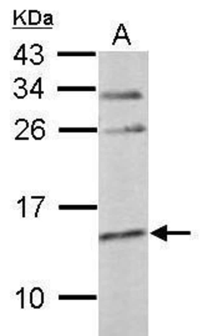 Anti-Cystatin C